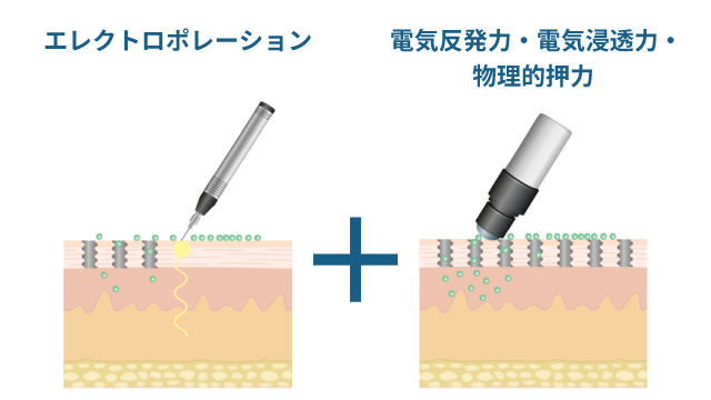 メソポレーション法