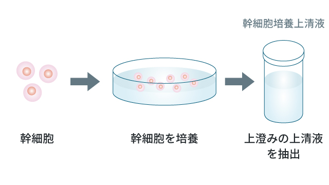 エクソソーム療法に用いる「幹細胞培養上清液」