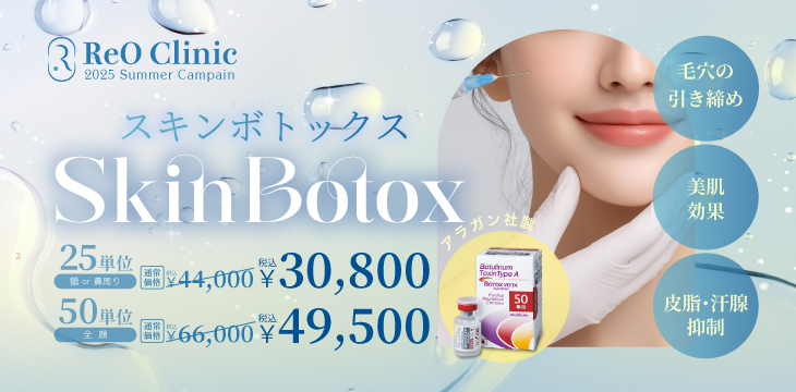 スキンボトックス キャンペーン実施中